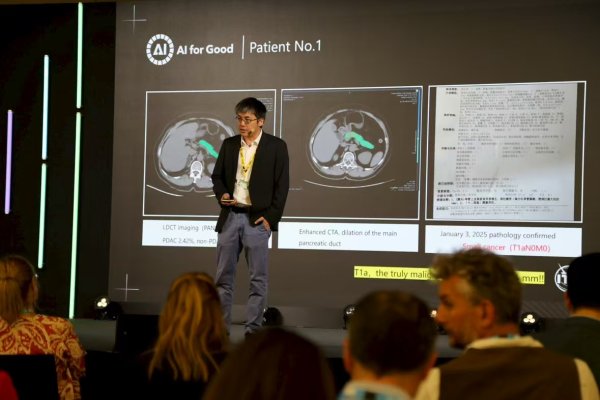 卓越汇 阿里达摩院张灵：推动AI成为人类社会抗击癌症的重要工具